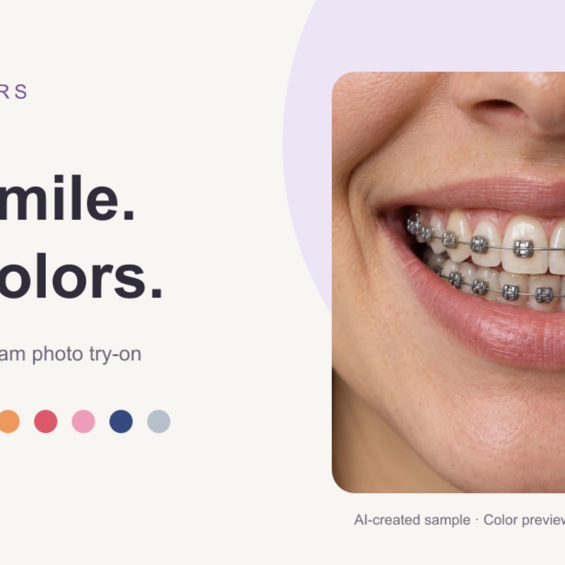 Braces Colors